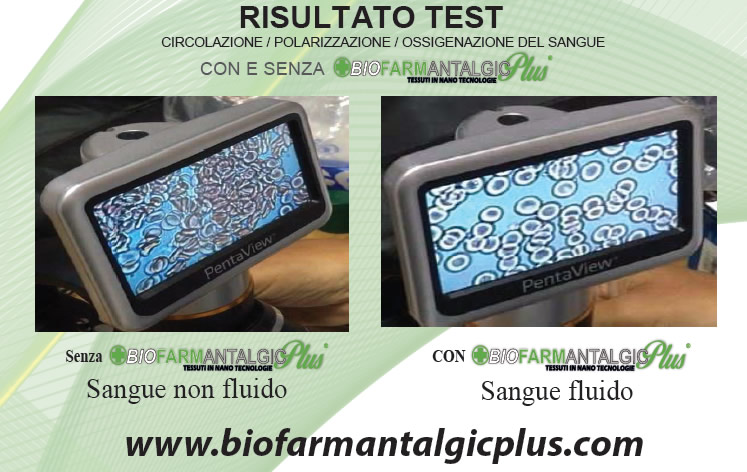 Risultato TEST